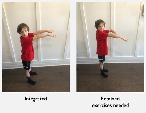 Understanding Primitive Reflexes: How They Impact Child Development and Intervention Strategies for Integration Primitive Reflex Integration, Primitive Reflexes Chart, Retained Primitive Reflexes Exercises, Stnr Reflex Integration, Stnr Reflex Integration Activities, Primitive Reflex Integration Exercises, Atnr Reflex Integration Activities, Kid Exercise, Nbcot Exam