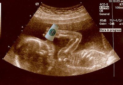 Ahahaha!!! I love it!!! Lab Humor, Girl Problems, Coffee Love, Ultrasound, Coffee Humor, Future Kids, My Way, Make Me Smile, Just In Case