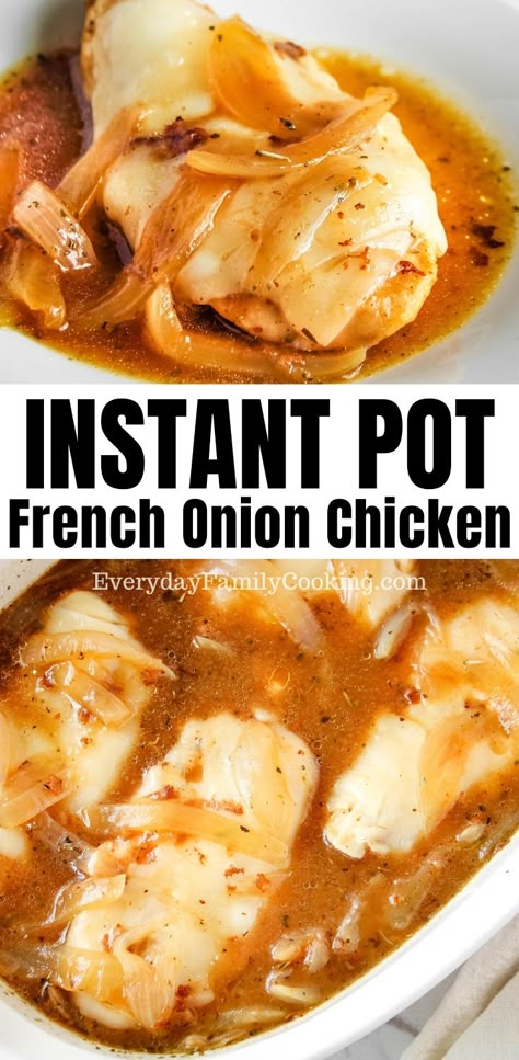 Chicken With Beef Broth Recipes, French Onion Chicken Instant Pot, Instant Pot Chicken Recipes Breast, Instant Pot Chicken Breast Recipes Easy, Chicken Breast Pressure Cooker Recipes, Chicken Breast Pressure Cooker, Instapot Chicken Breast, Instant Pot Chicken Recipes Healthy, Chicken Breasts Instant Pot