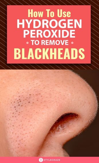 Fitness Hacks, To Remove Blackheads, Blackheads On Nose, Ootd Instagram, Remove Blackheads, Cold Sores Remedies, Natural Sleep Remedies, Get Rid Of Blackheads, Cold Home Remedies