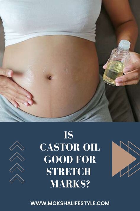 What are the best ways to use Castor Oil for stretch marks? Castor Oil Stretch Mark, Helichrysum Essential Oil Uses, Belly Oil Pregnancy, Stretch Mark Cream Pregnancy, Remedies For Skin, Strech Marks, Stretch Mark Remedies, Helichrysum Essential Oil, Belly Oil