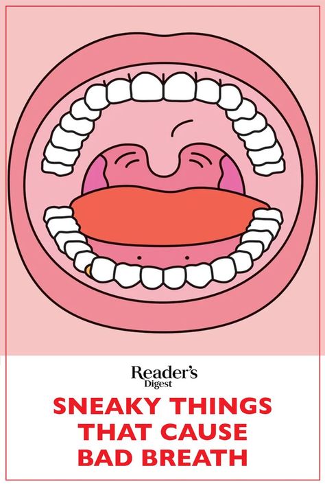 The best way to beat bad breath is to stamp it out at its source. Here's how. Mouth Care, Prevent Bad Breath, Bad Breath Remedy, Healthy Book, Common Factors, Dry Mouth, Natural Antibiotics, Natural Teeth Whitening, Cold Sore