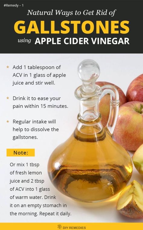 Gallbladder Cleanse, Apple Cider Vinegar Remedies, Gallbladder Diet, Gall Bladder, Natural Healing Remedies, Diy Remedies, Work Harder, Natural Therapy, Natural Health Remedies