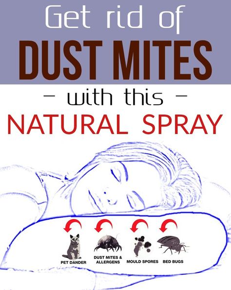 'Get rid of dust mites with this natural spray - 101CleaningTips.net...!' (via 101CleaningTips.net - Find free tips for your home) Dust Mite Spray, Lazy Cleaning, Dust Mite Allergy, Dust Allergy, Allergy Remedies, Deep Cleaning Tips, Homemade Cleaning Products, Household Cleaning Tips, Cleaners Homemade