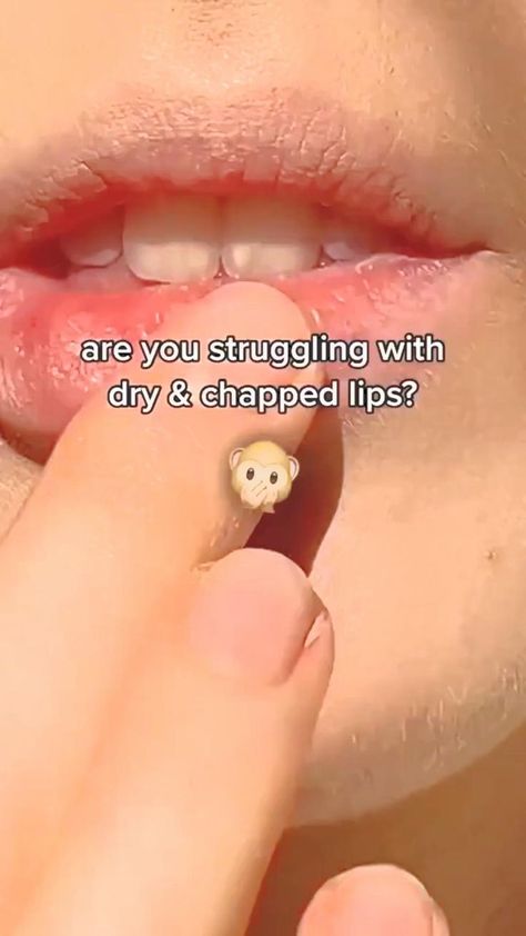 Dry Lips? 👄 💄💋 in 2022 | Skin care routine steps, Glowing skincare, Good day quotes How To Help Dry Lips, Tips For Dry Lips, Dry Lips Tips, Lip Care Routine, Healthy Lips, Diy Body Care, Perfect Skin Care Routine, Glowing Skincare, Healthy Skin Tips