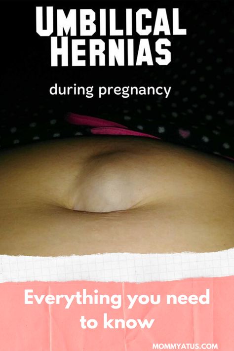 Umbilical Hernias In Women, Hernias In Women, 25 Weeks Pregnant, Pregnancy Belly Band, Women Health Care, Women Health, Lower Belly, Pregnancy Care, Health Knowledge