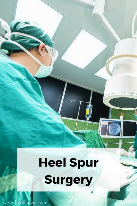 Heel spur surgery should be a last resort. Learn about the surgery, recovery time, and alternative home treatments. Bone Spur On Back Of Heel, Achilles Tendon Surgery Recovery, Bone Spur Heel, Heal Spurs, Heel Spur Relief, Ankle Surgery Recovery, Calcaneal Spur, Heel Spur, Ankle Surgery