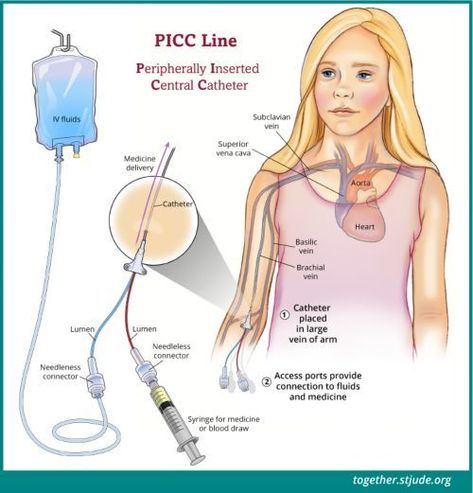 Picc Line Nursing, Central Venous Catheter, Picc Line, Iv Line, Nursing School Essential, Child Life Specialist, Nurse Study Notes, Nursing Student Tips, Nursing School Survival