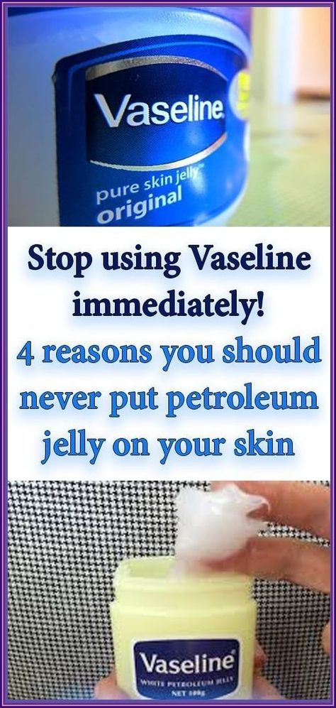 Stop Using Vaseline Immediately! Petroleum Jelly, Vaseline, Health Remedies, Apple Cider, Home Remedies, Natural Remedies, Baking Soda, Your Skin, Health Tips