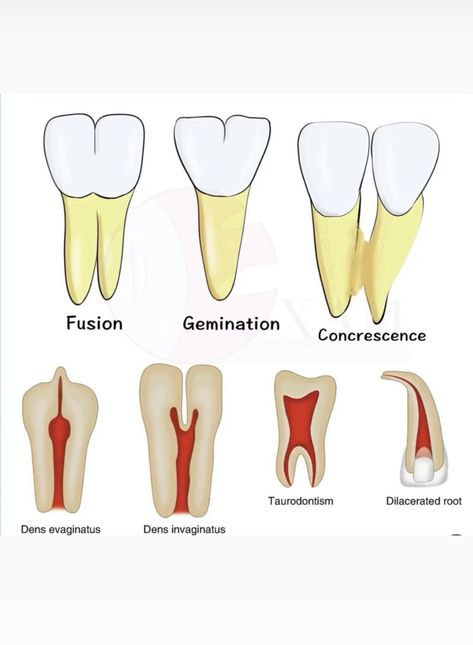 Dental Assistant Study Guide, Dental Notes, Dental Hygienist School, Hygiene School, Dental Assistant Study, Dental Hygiene Student, Oral Pathology, Dental World, Dental Hygiene School