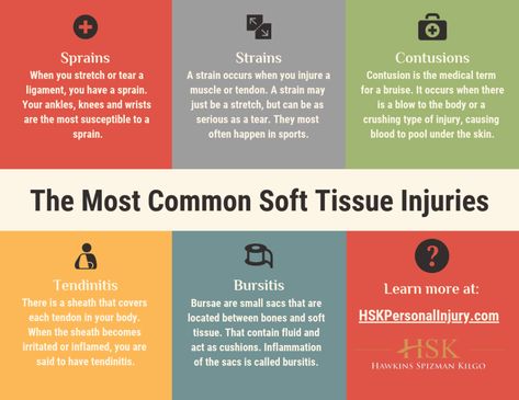 The Most Common Soft Tissue Injuries ... Nurse Notes, Soft Tissue Injury, Rehabilitation Exercises, Ligament Tear, Sports Therapy, Study Board, Medical Kit, Medical Terms, Chiropractic Care