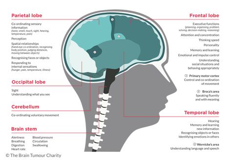 Brain Tumour, Brain Surgeon, Cerebral Cortex, Brain Scan, Brain Stem, Spatial Relationships, Health Guru, Memory Problems, Brain Surgery