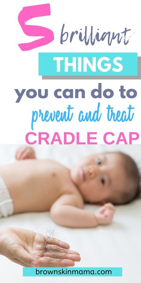 Lear how to get rid of and prevent further bouts of cradle cap attacking your baby's hair.  These tips will help you to treat the problem and keep it under control #newbaby #brownskinmama #newmomtips Grow Baby Hair, Cradle Cap Remedies, Baby Cradle Cap, Taking Care Of Baby, Cap Baby, Cradle Cap, Flaky Scalp, Baby Planning, Natural Parenting