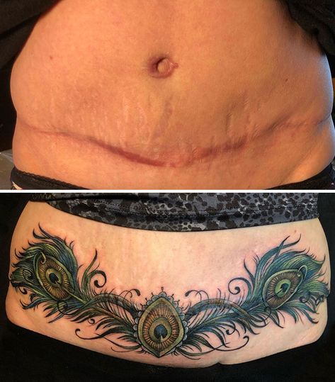 Lower Body Lift Scar Tattoo, Upper Thigh Tattoo Scar Cover, C Section Scar Tattoo Cover Up, Stretchmark Cover Tattoos, Breast Reduction Scar Tattoo, Tramp Stamp Cover Up Tattoos Before And After, C Section Tattoo Cover Up, Tummy Tucks Tattoo Cover Up, C Section Scar Tattoo