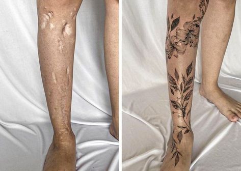 Scar tatoo art Leg Scars, Terrible Tattoos, Mama Tattoo, Tattoo Over Scar, Scar Cover Up, Mastectomy Tattoo, Tattoos To Cover Scars, Full Leg Tattoos, Scar Tattoo