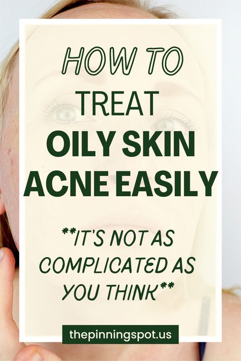 How to treat acne. If you have acne caused by oily skin, then here's a post to show you how to treat acne and keep your oily skin acne free. How To Treat Hormonal Acne, Treat Oily Skin, Get Rid Of Oily Skin, Comedonal Acne, Oily Skin Remedy, Acne Products, Get Clear Skin, Oily Skin Acne, Acne Causes