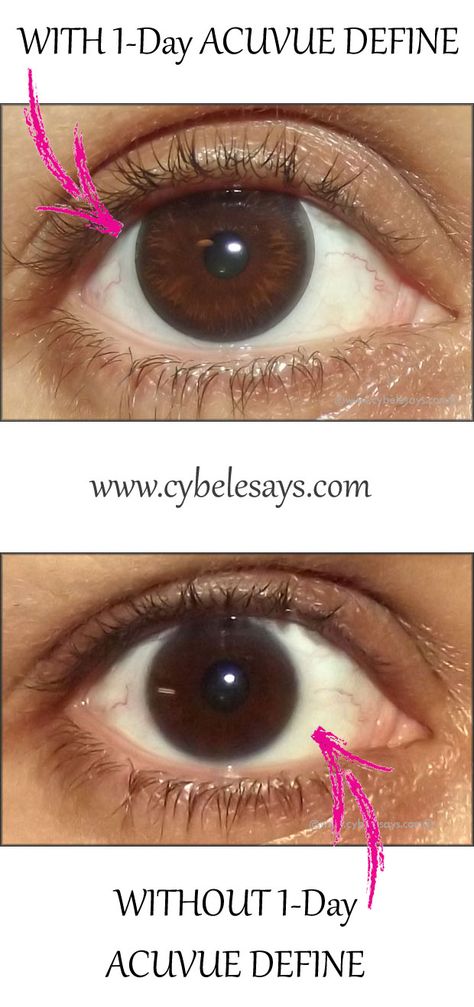 Check out my eye with and without 1-Day ACUVUE DEFINE. Big difference! @acuvue #bbloggers Acuvue Define, Colored Contact Lenses, Beauty Tricks, Contact Lenses Colored, Colored Contacts, Contact Lenses, Beauty Blogger, New Technology, Beauty Blog