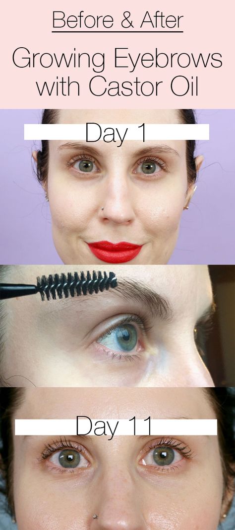 Can you DIY growing your eyebrows out with castor oil? I tried for 11 days and my results will shock you! Click above to see the type of castor oil I used and watch my progress from day 1 to day 11. Eyelash Castor Oil, Oils For Eyebrow Growth, Caster Oil Eyelashes Before And After, Caster Oil Lashes, Castor Oil For Eyelash Growth, Growing Out Eyebrows Before And After, Castor Oil For Hair Growth Eyebrows, Castor Oil For Hair Growth Before After, Growing Eyebrows Out