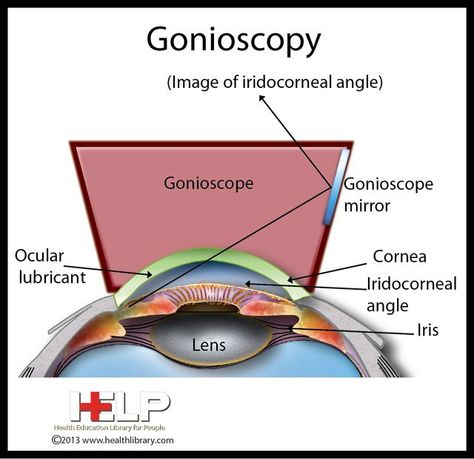 Eye Anatomy Diagram, Ophthalmic Assistant, Opthalmic Technician, Eye Health Facts, Optometry Education, Eye Medicine, Lower Blood Pressure Naturally, Certified Medical Assistant, Eye Facts