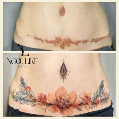 C Section Scar Tattoo, Tummy Tattoo, Tattoo Over Scar, Mastectomy Tattoo, Scar Cover Up, Tattoos To Cover Scars, Scar Tattoo, Healing Tattoo, Tattoo Magazines