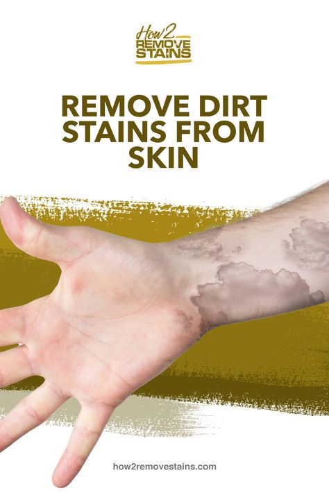 How to remove dirt stains from skin   [ Detailed Answer ]    Visit How2RemoveStains.com Dirt Removal From Skin, How To Remove Dirt From Skin, Remove Dirt From Skin, How To Remove Grass, Dry Cracked Hands, Glam Wedding Makeup, Cracked Hands, Grass Stains, Tan Removal