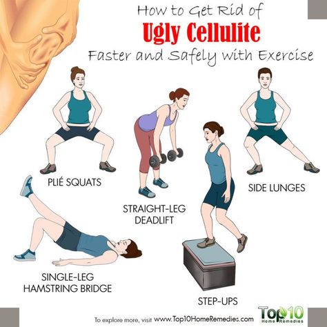 How to Get Rid of Cellulite Fast and Safely with Exercise | Top 10 Home Remedies Straight Leg Deadlift, Plie Squats, Aerobics Classes, Top 10 Home Remedies, Squats And Lunges, Side Lunges, Thigh Exercises, Workout Tops, Your Skin