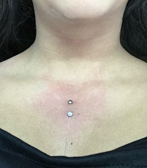 Sternum piercing, vertical surface. Surface Bar Piercing Chest, Chest Surface Piercing, Chest Dermal Piercing Center, Sternum Piercing Surface, Surface Piercing Chest, Sternum Piercing Dermal, Dermal Piercing Chest, Chest Dermal, Sternum Piercing