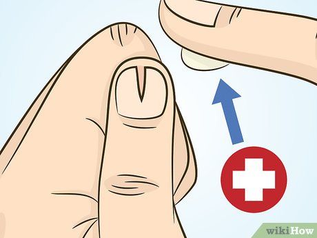 How To Repair A Split Fingernail, How To Repair Split Nails, How To Fix A Split Nail, Repair Split Nail, How To Stop Nails From Splitting, Nail Break Repair, Split Fingernails Remedies, Repair Nails After Acrylics, Ripped Nail Bed Repair