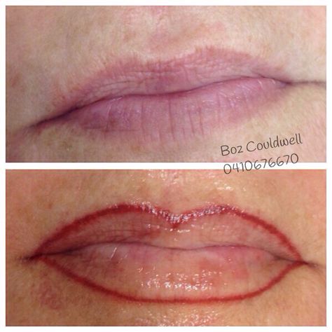 Lip line Medical Tattoo, Lip Line, Cosmetic Tattoo, How To Line Lips, Medical, Lips, Tattoos