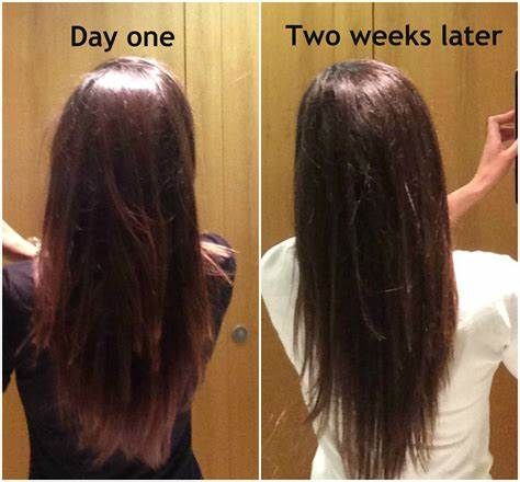 Before And After My Hair Loss Journey Tryu this once One Year Hair Growth, Before And After Hair Growth, Aunt Jackies Hair Products, Best Hair Vitamins, Causes Of Hair Fall, Hair Growth Journey, Vitamins For Hair, Before And After Hair, Hair Fall Solution