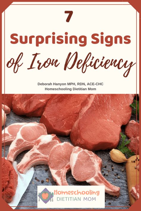 Food Good For Iron Deficiency, Foods High In Iron For Pregnancy, Iron Rich Foods For Pregnancy, Good Sources Of Iron, Iron Deficiency Memes Funny, Iron Deficiency, Registered Dietitian Nutritionist, Vitamins For Kids, Registered Dietitian