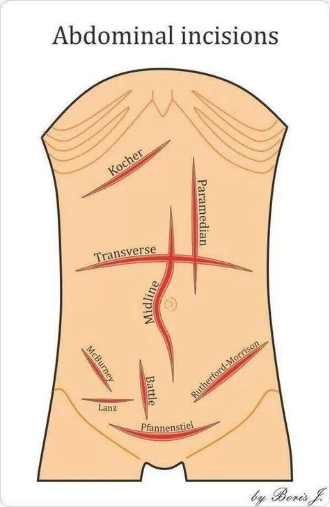 Surgical Incisions, Surgical Technologist Student, Studera Motivation, Nursing School Essential, Nursing School Motivation, Medical School Life, Basic Anatomy And Physiology, Nurse Study Notes, Medical Student Motivation