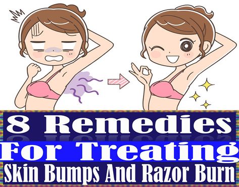 8 Remedies For Treating Skin Bumps And Razor Burn  #skin #skincare #skinbumps #razorburn #fitness #beauty #remedies How To Treat Razor Burn, Benefits Of Vaseline, Coconut Oil Remedies, Coconut Oil Sugar Scrub, Vaseline Jelly, Itchy Rash, Dry Skin Problem, Skin Bumps, Shaving Tips