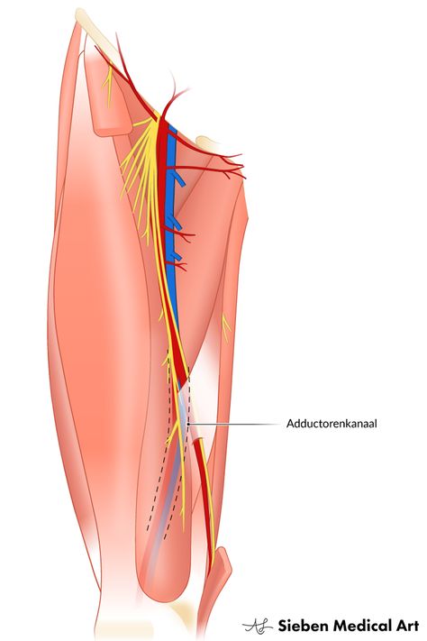 The adductor canal (Hunter’s canal, subsartorial canal) is a narrow conical tunnel located in the human thigh. It extends from the apex of the femoral triangle to the adductor hiatus of the adductor magnus and serves as a passageway from structures moving between the anterior thigh and posterior leg. This illustration was made for the E-learning Development Team of the UMCG. It is used in an e-learning module for medical students on the anatomy of the leg. || anatomical drawing || science art Adductor Canal Anatomy, Femoral Triangle, Learning Development, Medicine Notes, Medical Student Study, Human Leg, Human Body Anatomy, Lower Limb, Medical Art