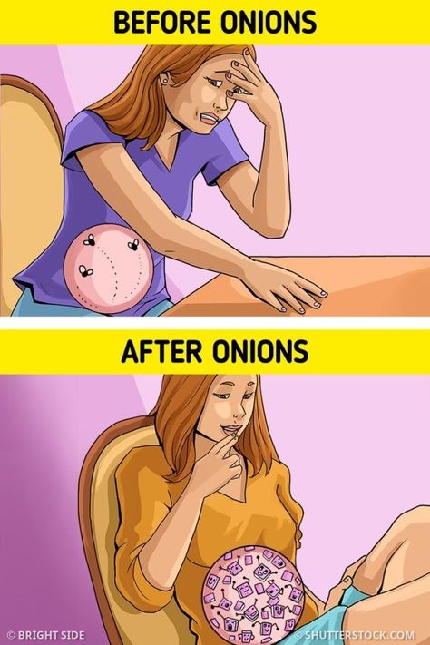 We at Bright Side gathered 5 benefits of onions you can feel if you eat them every day. Don’t miss our bonus that tells you about onions’ healing abilities. Benefits Of Onions, Onion Benefits, Healing Abilities, Hygiene Care, Health Management, Oral Health Care, Tooth Decay, Holistic Wellness, Health Advice