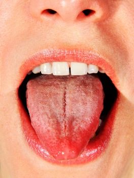 Ingimage | Stock Image Details: ISS_4253_03089 - opened mouth of woman with put her tongue out Mouth References, Mouth Reference, Opened Mouth, Tongue Health, Chill Room, Ketogenic Diet Meal Plan, Receding Gums, Reference Photos, Oral Hygiene