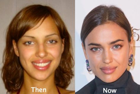 Irina Shayk. Nose tip sharpened Microbladed Eyebrows, Nose Tip, Nose Jobs, Botox Lips, Perfect Nose, Celebrity Plastic Surgery, Celebrities Before And After, Reconstructive Surgery, Lip Injections