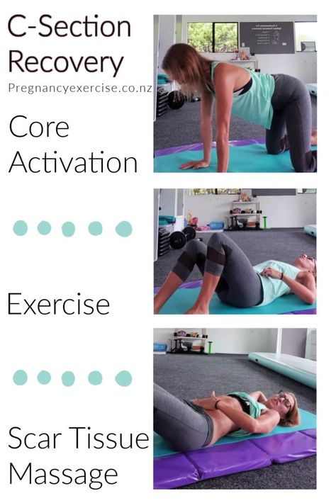 C Section Exercise Recovery, C Section Recovery Exercise Workouts, Post C Section Workout Plan, C Section Core Recovery, C Section Recovery Workout, Post Cesarean Workout Exercises, Workouts After C Section, C Section Exercise Workouts, C Section Recovery Exercise