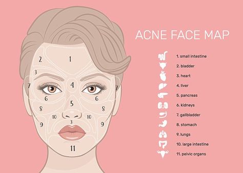 While aches and pains are common signs of illness, Emma has revealed how your face can be a reflection of your inner health too (stock image) Gesicht Mapping, Doterra Acne, Acne Face Map, Face Map, Face Mapping Acne, Pimples On Face, Face Mapping, Acne Face, Acne Face Wash