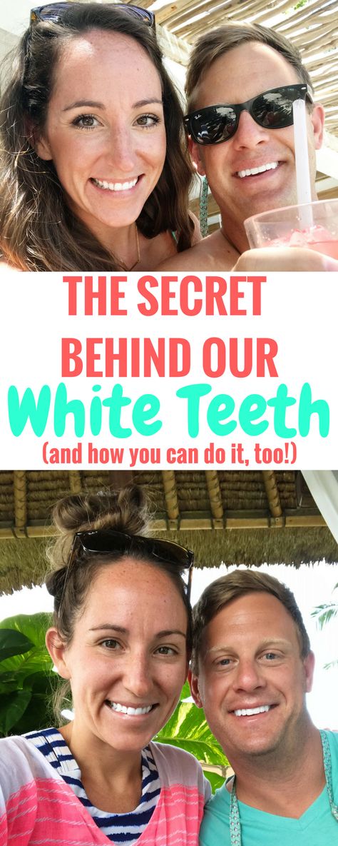 Quick Teeth Whitening Diy, Best Teeth Whitening Toothpaste, Natural Ways To Whiten Teeth, Best Teeth Whiteners, Natural Tooth Whitener, Home Made Teeth Whitening, Best Teeth Whitening Products Drugstore, Best Way To Whiten Teeth At Home, How To Get Super White Teeth