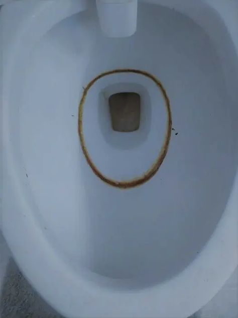 How To Clean Toilet Bowl Ring How To Remove Toilet Bowl Ring, Clean Toilet Bowl Ring, Cleaning Toilet Ring, Toilet Bowl Ring Remover, Toilet Bowl Ring, Toilet Bowl Stains, Toilet Ring, Toilet Stains, Clean Toilet