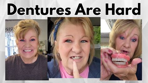 Dentures Two Years In Dentures Tips, Pictures Of Women, Dentures, Oral Health, Health