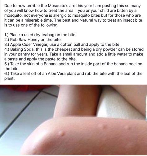 Also putting a hot spoon on it will completely get rid of the itchyness. Hot Spoon Bug Bites, How To Get Rid Of Mosquito Bites Fast, Treat Mosquito Bites, Get Rid Of Mosquito Bites, Allergic To Mosquito Bites, Adulting Hacks, Mosquito Bites, Natural Beauty Products, Survival Life Hacks