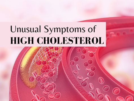 Signs Of High Cholesterol, High Cholesterol Symptoms, Enlarged Liver, Cholesterol Symptoms, High Cholesterol Levels, Unhealthy Diet, Lifestyle Habits, High Cholesterol, Abdominal Pain