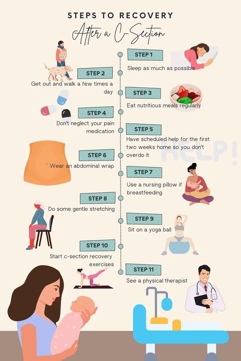 Post C Section, C Section Workout, Postpartum Care Kit, Birth Recovery, C Section Recovery, Baby Delivery, Post Pregnancy Workout, Healthy Pregnancy Tips, Newborn Mom