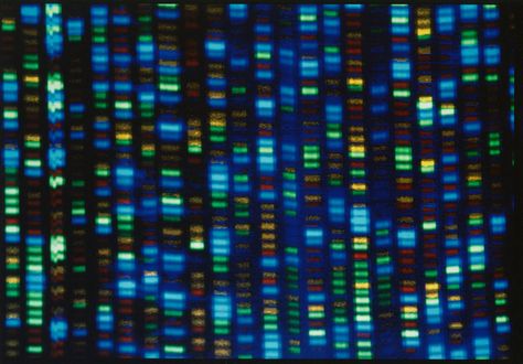 The blueprint human genome is still mostly based on a single man from Buffalo, NY. National Human Genome Research InstituteInstead of looking at one single genome, researchers are mapping out "a network of possibilities.” The post The benchmark for human diversity is based on one man’s genome. A new tool could change that. appeared first on Popular Science. Human Diversity, Guillain Barre Syndrome, Genome Sequencing, Science Study, Fruit Nutrition, Genetic Variation, African Ancestry, Dna Sequence, Human Genome