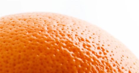 How to fix "orange peel skin," which involves divots and bumps under the surface. Orange Peel Skin, Orange Peel Texture, Face Pores, Orange Skin, Food Texture, Natural Pain Relief, Peeling Skin, Large Pores, Skin Pores