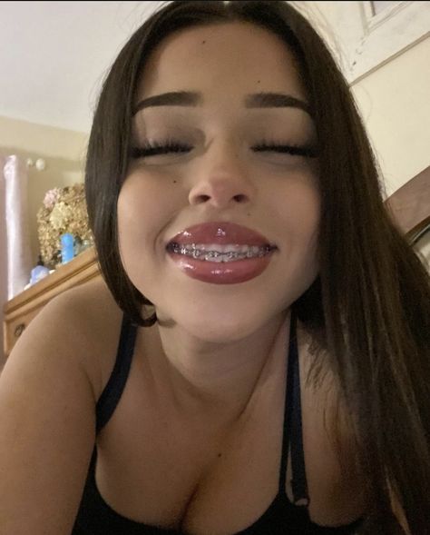 Lantinas Girl, Selfie Pretty Woman, Makeup With Braces, Pretty Girl Braces, Teeth Braces Aesthetic, Cute Braces Colors Aesthetic, Pretty Latina Makeup, Light Pink Braces, Franchise Pfp