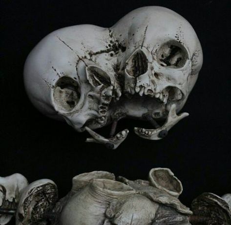 Skulls of Siamese twins ... Emil Melmoth, Angel Of Love, Skull Anatomy, Skull Reference, Vulture Culture, Skulls Drawing, Skull Island, Macabre Art, Human Skull