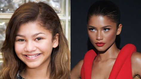 Many fans are curious about whether or not Zendaya received a nose job to improve the contour of her nose. According to experts, her nose’s wings have gotten narrower and more graceful, and the nostrils have become smaller and neater even though she was born with broad nose wings which were not perfect. Broad Nose, Bulbous Nose, The Untold Truth, Nose Surgery, Nasolabial Folds, Nose Job, Skin Care Routine Steps, Hollywood Celebrities, Not Perfect